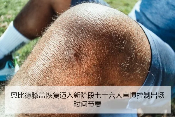 恩比德膝盖恢复迈入新阶段七十六人审慎控制出场时间节奏